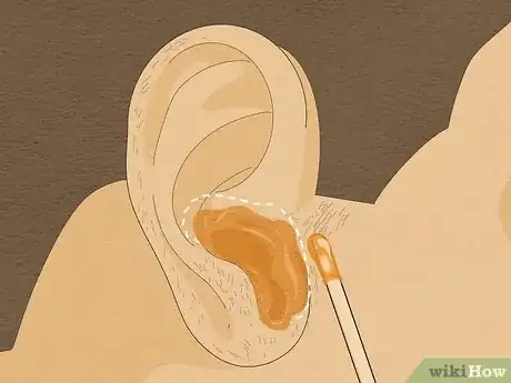 Image titled Wax Ear Hairs Step 6