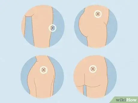 Image titled Get an Injection Without It Hurting Step 17