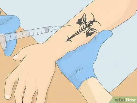 Image titled Fix a Bad Tattoo Step 8