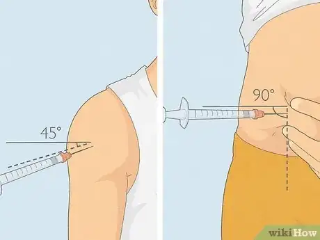 Image titled Get an Injection Without It Hurting Step 19