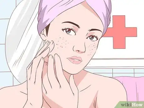 Image titled Get Rid of Acne Without Using Medication Step 35