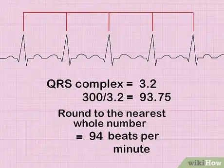 Image titled Calculate Heart Rate from ECG Step 4