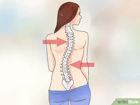 Image titled Treat Scoliosis Step 4