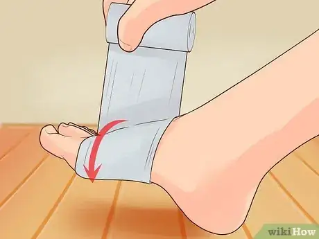 Image titled Wrap an Ankle Step 2