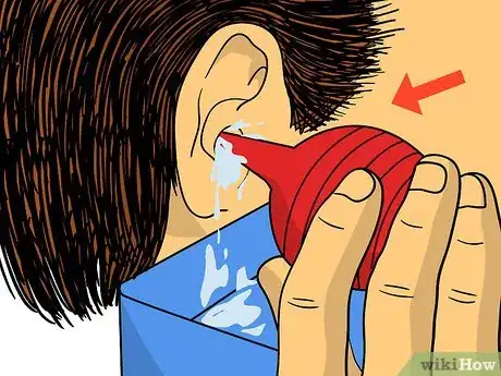 Image titled Get Rid of Swimmer's Ear Step 7