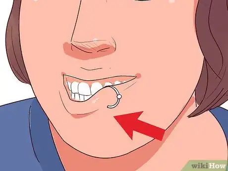 Image titled Take out a Lip Ring Step 3