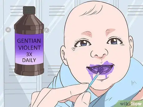 Image titled Get Rid of Thrush in Infants Step 10