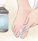 Prevent Smelly Feet