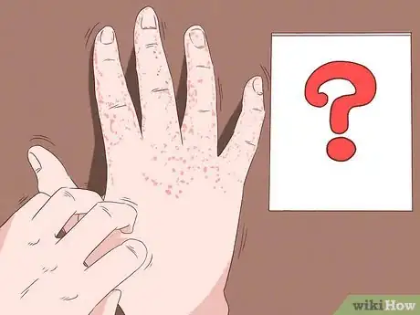 Image titled Prevent Skin Rashes Step 9