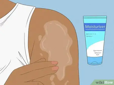 Image titled Cope with Itchy Skin During Menopause Step 2