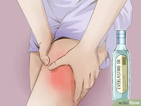 Image titled Use Herbs for Sprains and Bruises Step 3