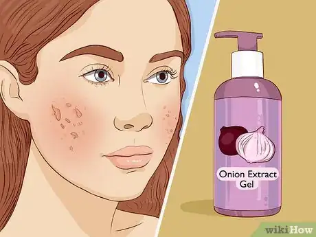 Image titled Take Care of Your Skin With Natural Methods Step 13