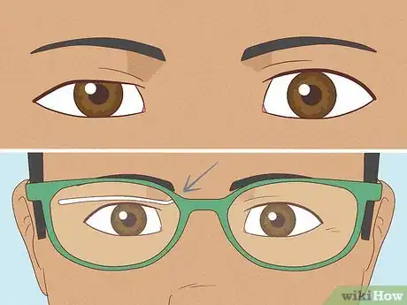 Image titled Fix Asymmetrical Eyes Step 1