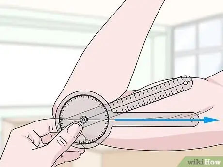 Image titled Use a Goniometer Step 3