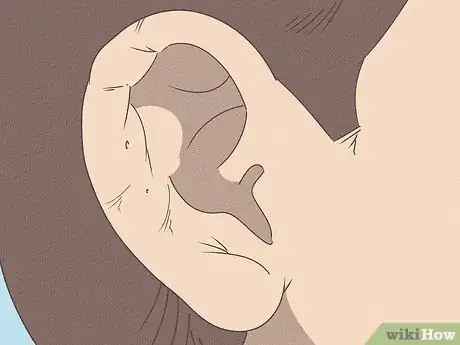 Image titled Pierce Your Own Cartilage Step 15