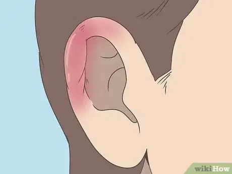 Image titled Pierce Your Own Cartilage Step 13