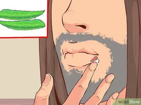 Image titled Grow and Use Aloe Vera for Medicinal Purposes Step 10