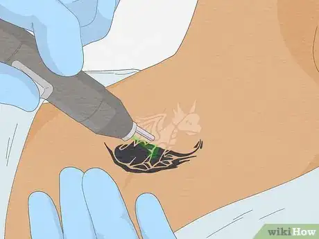 Image titled Fix a Bad Tattoo Step 4