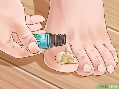 Image titled Use Essential Oils Step 7