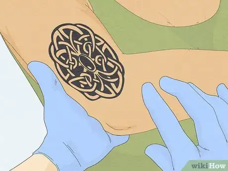 Image titled Fix a Bad Tattoo Step 5