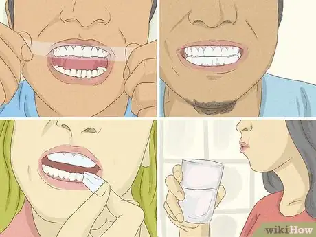 Image titled Get Whiter Teeth at Home Step 7