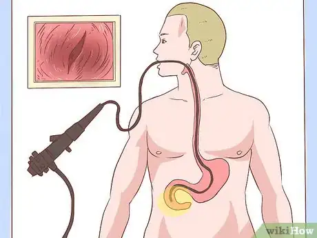 Image titled Know if You Have Gastritis Step 8