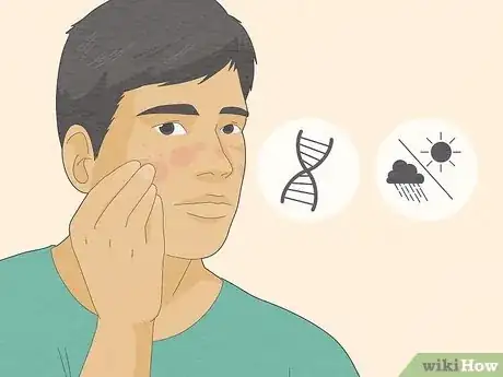 Image titled Know if Skin Barrier Is Damaged Step 10