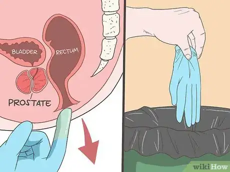 Image titled Locate Your Prostate Step 10