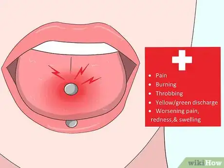 Image titled Reduce Tongue Swelling Step 16