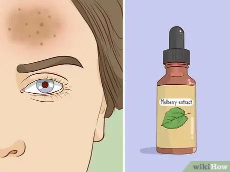 Image titled Get Rid of Brown Spots Using Home Remedies Step 3