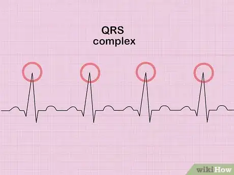 Image titled Calculate Heart Rate from ECG Step 2