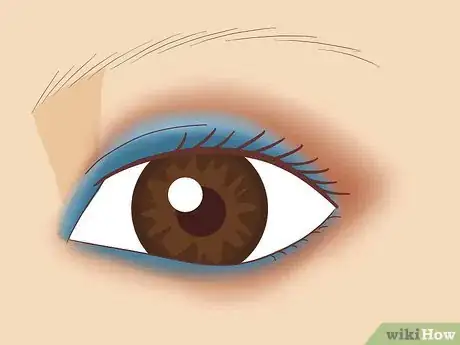 Image titled Get Blue Eyes Step 3