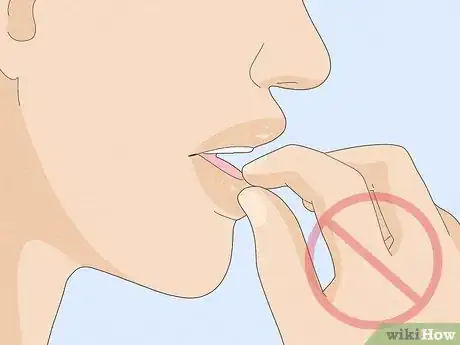 Image titled Treat and Prevent Dry or Cracked Lips Step 11