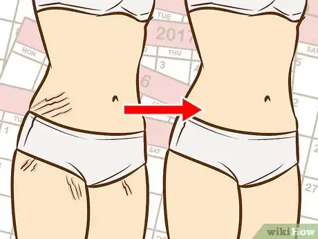 Image titled Get Rid of Stretch Marks on Your Back Step 3