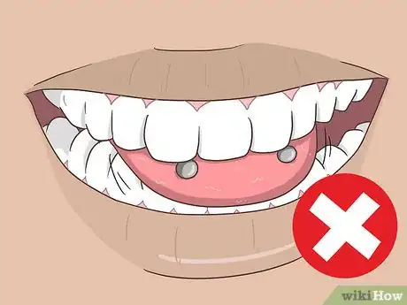 Image titled Reduce Tongue Swelling Step 14