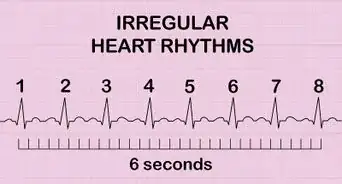 Calculate Heart Rate from ECG