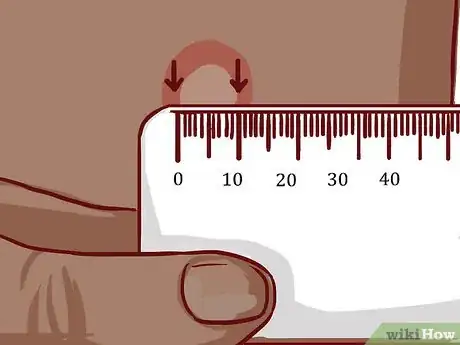 Image titled Read a Tuberculosis Skin Test Step 6