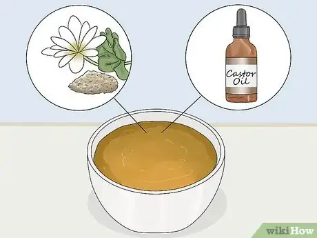 Image titled Bring a Cyst to a Head Step 8