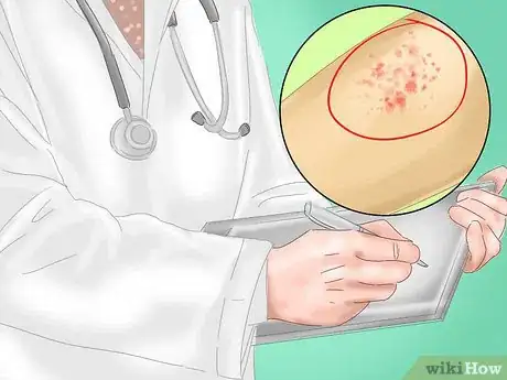 Image titled Identify Measles Step 5