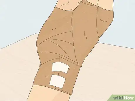 Image titled Wrap a Sprained Thumb Step 11