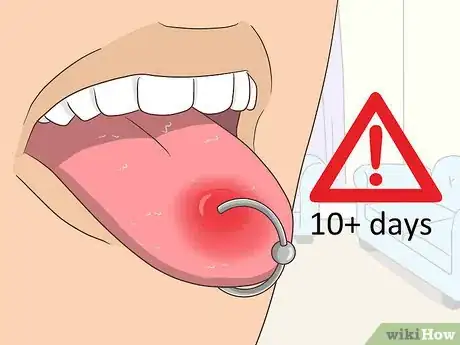 Image titled Reduce Tongue Swelling Step 18