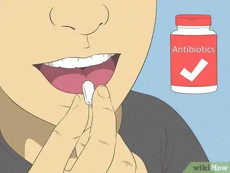 Image titled Get Rid of Tooth Pain Step 19