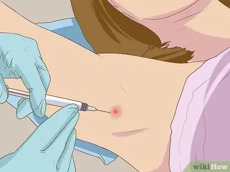 Image titled Get Rid of a Zit on Your Armpit Step 15