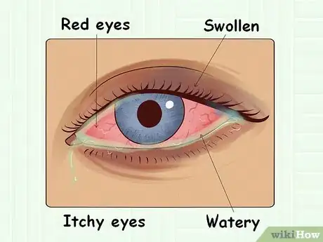 Image titled Stop Your Eye from Itching Step 8