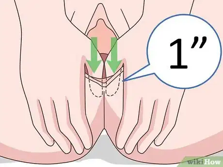 Image titled Do Perineal Massage Step 7