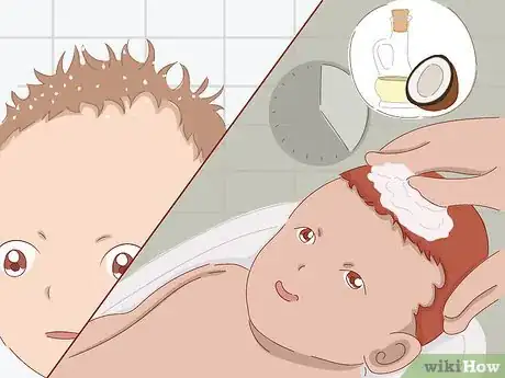 Image titled Wash Newborn Hair Step 9