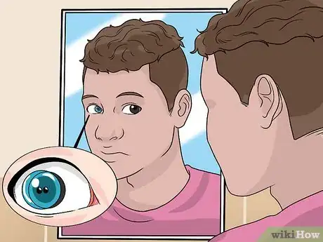 Image titled Remove Soft Contact Lenses After You Have Slept With Them Step 4