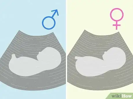 Image titled Tell if You're Pregnant with a Girl or Boy Step 19