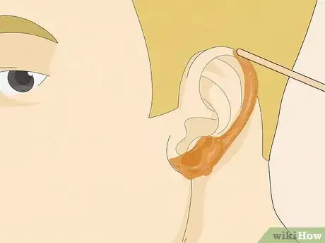 Image titled Wax Ear Hairs Step 11