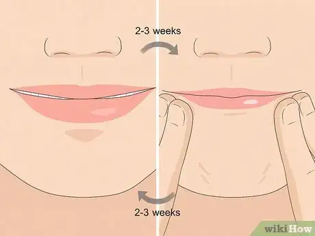 Image titled Get Rid of Jowls Step 3